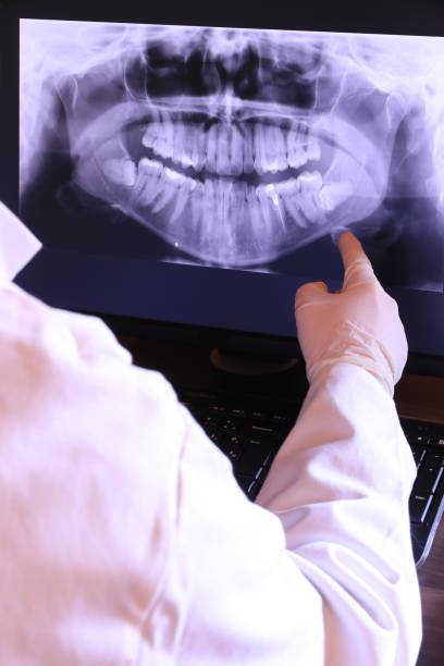 Best Emergency Root Canal Treatment in Augusta, ME